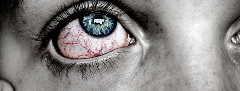 eye infection