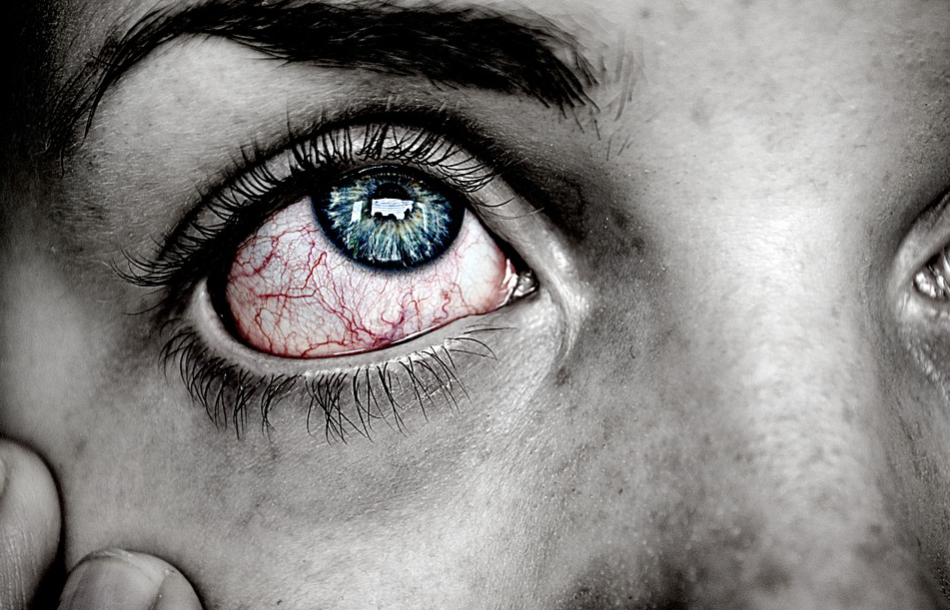 Natural Herbs to Treat Eye Infections post thumbnail image